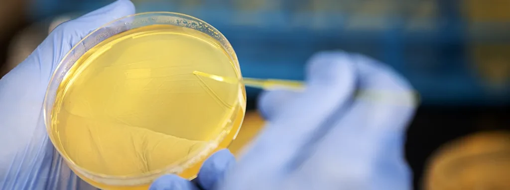 Een persoon die blauwe handschoenen draagt, houdt een doorzichtig petrischaaltje vast met daarin een gele substantie. Ze gebruiken een geel hulpmiddel om strepen op het oppervlak van de substantie te maken. De achtergrond is wazig, waardoor de nadruk op de petrischaal en het gereedschap ligt.